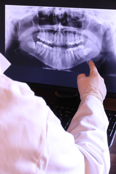 Best Emergency Denture Repair in Rossmoyne, OH